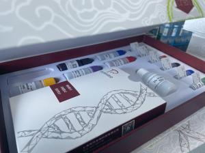 小鼠嗜铬粒蛋白A(CHGA) ELISA 试剂盒