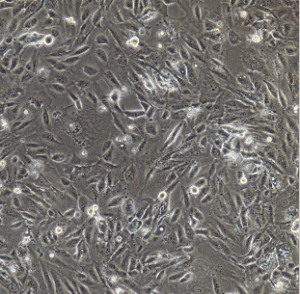 CNE-2低分化细胞 产品图片