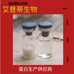 ACVR1B重组蛋白;高活性/ACVR1B protein 产品图片