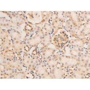 Phospho-NF-kB p65 (Ser536) Antibody #（AF2006）现货供应