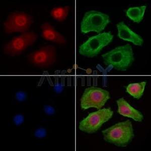 Bcl-2 Antibody #（AF6139）现货供应