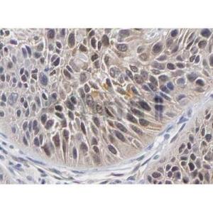 NF-kB p65 Antibody #（AF5006）现货供应