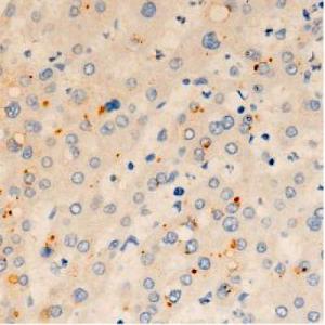 ORAI1 Antibody #（DF7956）现货供应