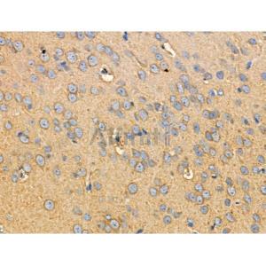 Phospho-RIPK2 (Ser176) Antibody #（AF0049）现货供应