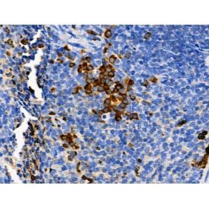 Phospho-PER2 (Ser662) Antibody #（AF4301）现货供应