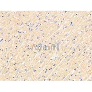 TSG6 Antibody #（AF5492）现货供应