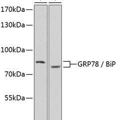 GRP78 / BiP Polyclonal Antibody #（27540）现货供应