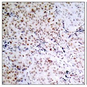 Rb(Phospho-Ser795) Antibody #11130