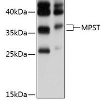 OriGene傲锐东源IL8(CXCL8)人重组蛋白(TP701252)