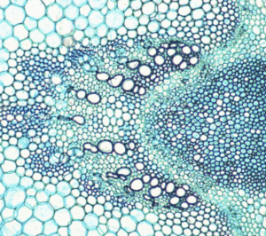 原始粒细胞急性淋巴细胞骨髓原始粒细胞 产品图片