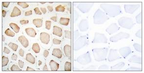 兔IV型胶原α1(COL4α1)酶联免疫试剂盒 