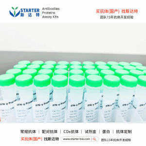 CD117 Recombinant Rabbit Antibody (Alexa Fluor® 594 Conjugate) (S-125-51)【中文名称:CD117 重组兔抗体】, 斯达特-国产抗体*