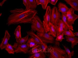 Fluorescein 594-Phalloidin(荧光素594标记鬼笔环肽)
