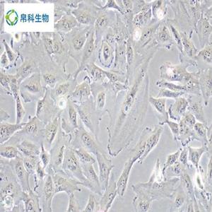 人原代肺大動脈平滑肌細胞